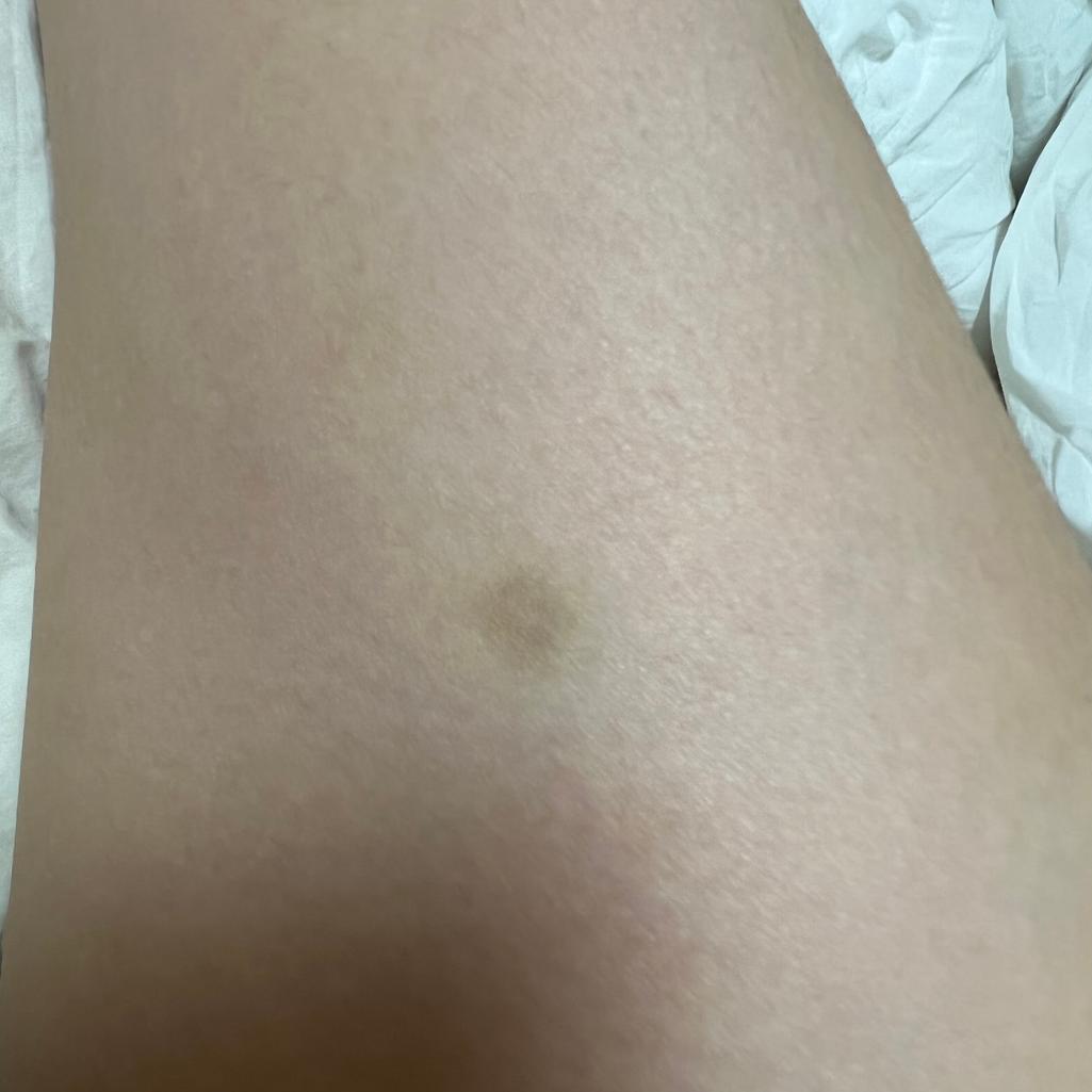 2번 째 사진