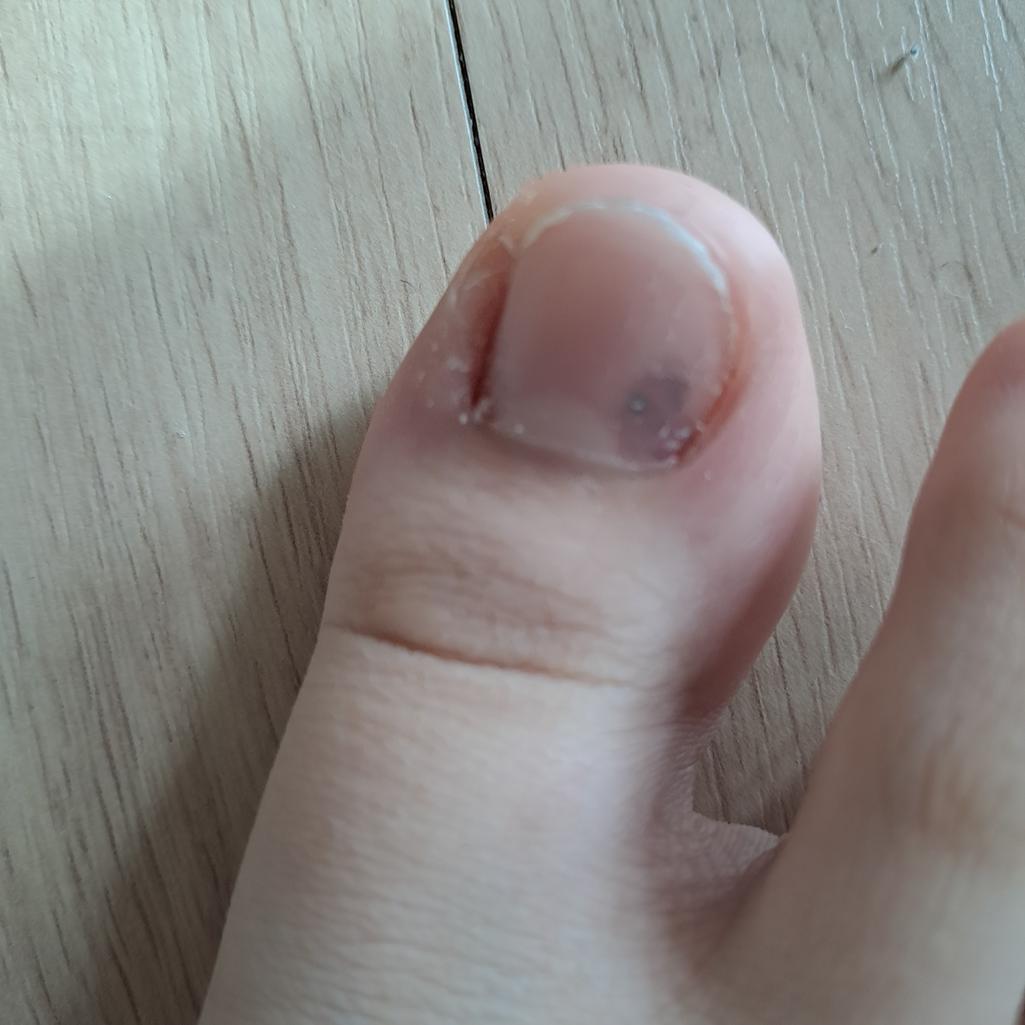 1번 째 사진