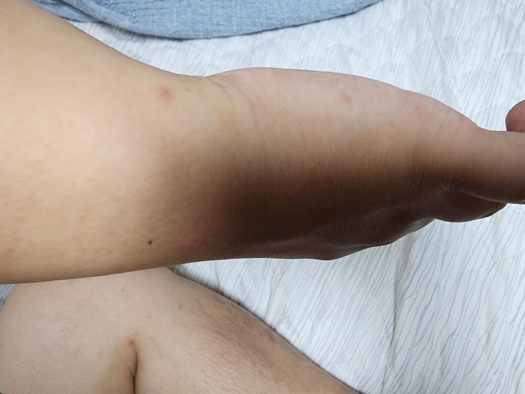 2번 째 사진
