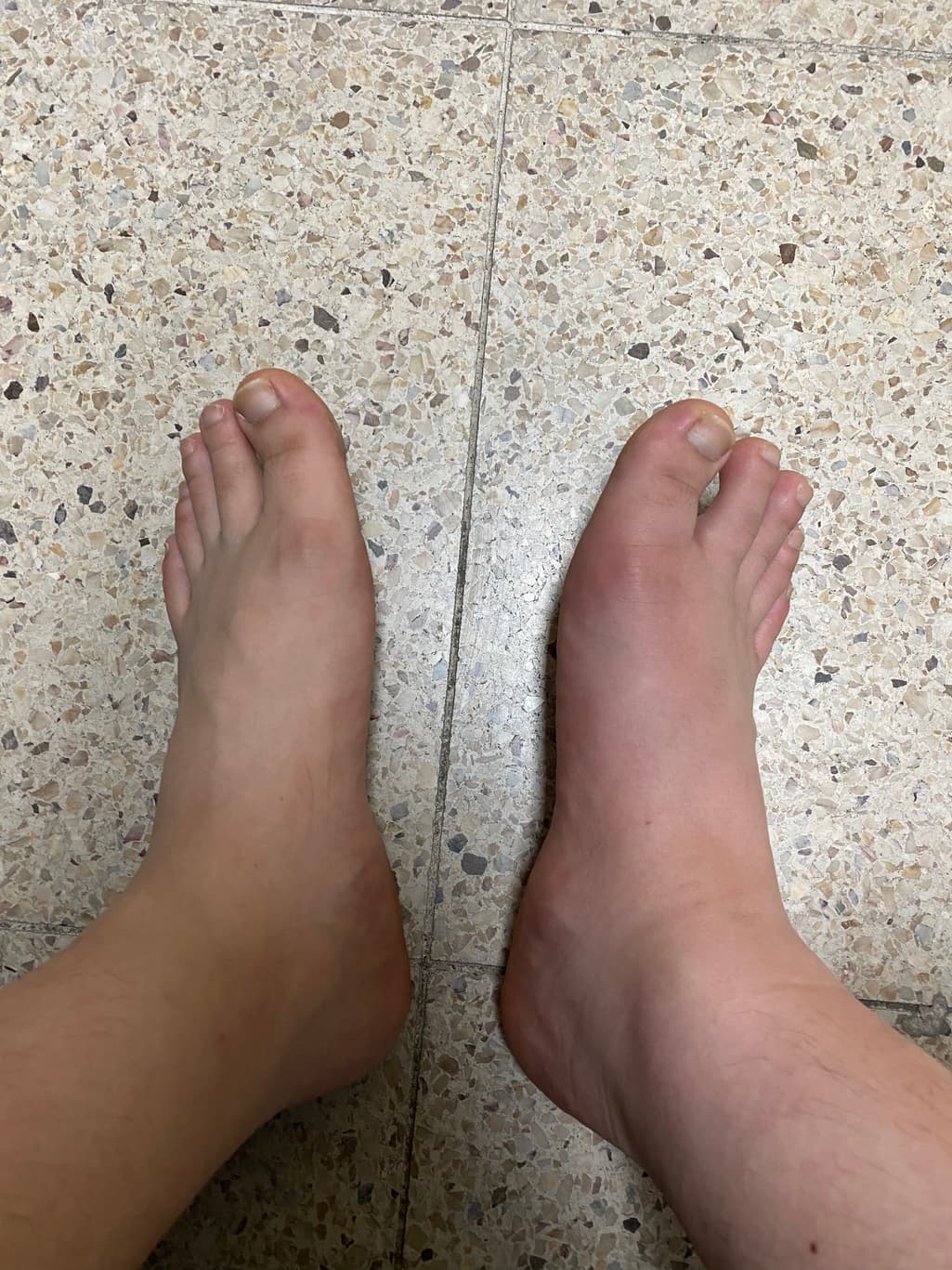 2번 째 사진
