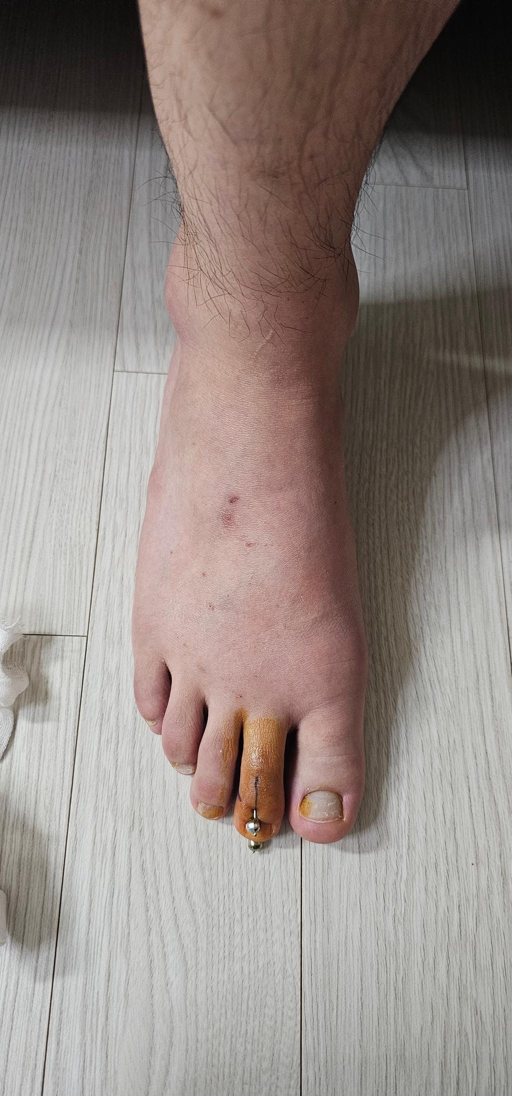 2번 째 사진