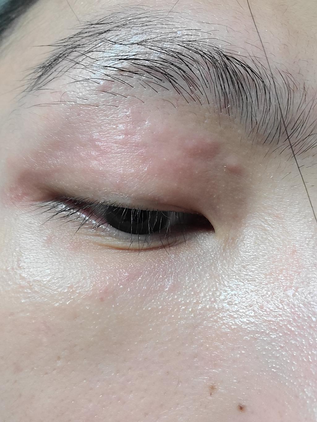 2번 째 사진