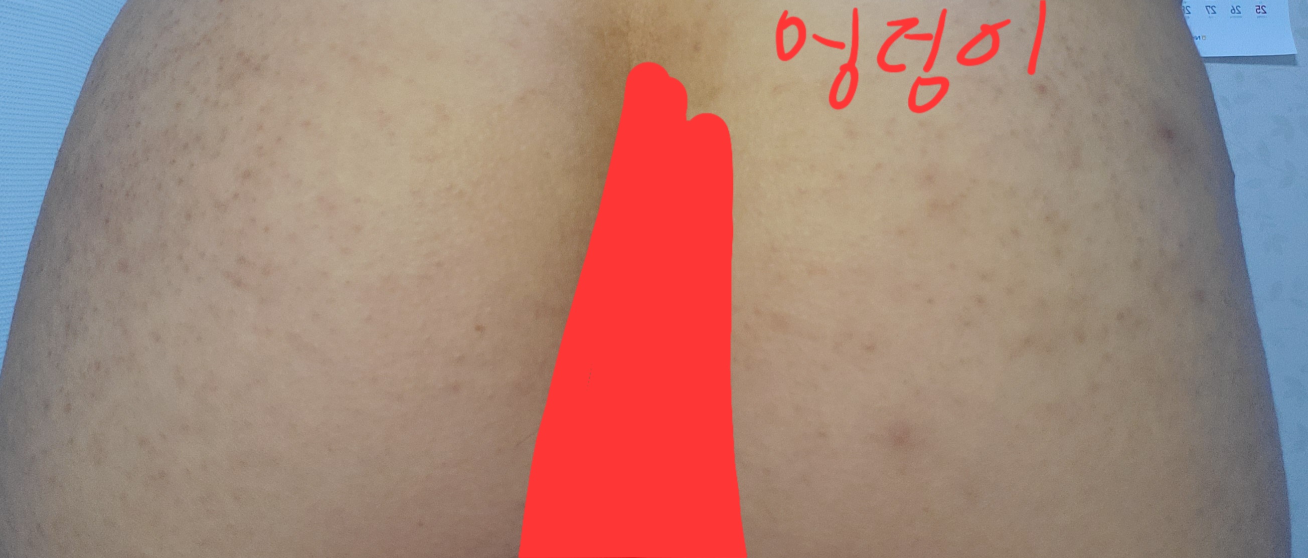 3번 째 사진