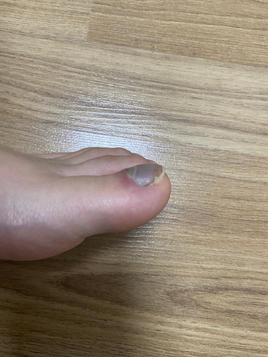 2번 째 사진