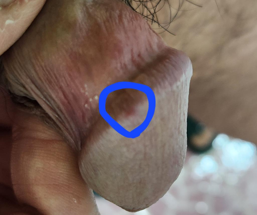 3번 째 사진