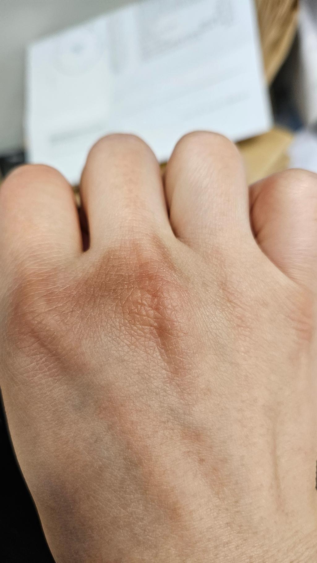 2번 째 사진