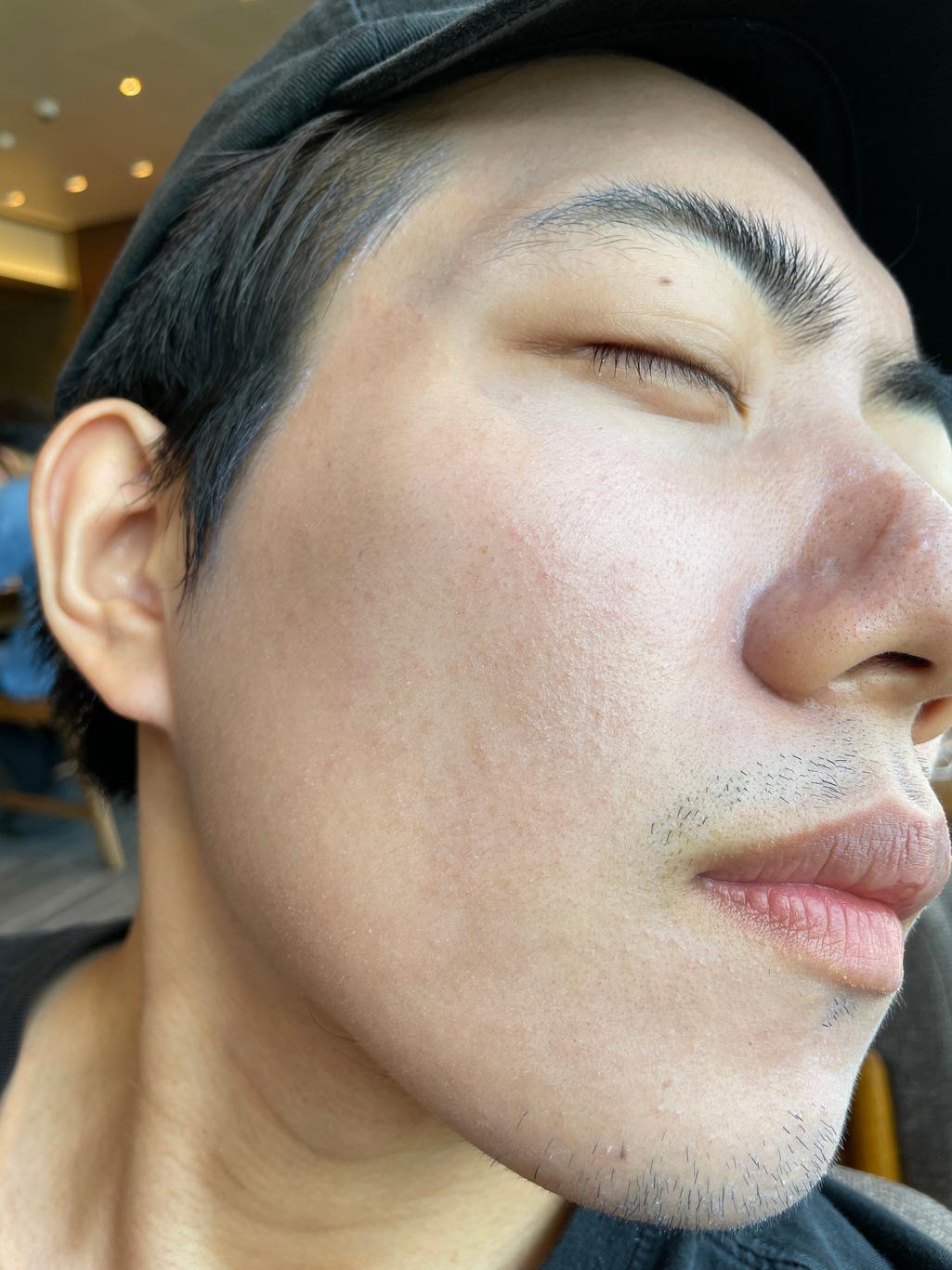 3번 째 사진