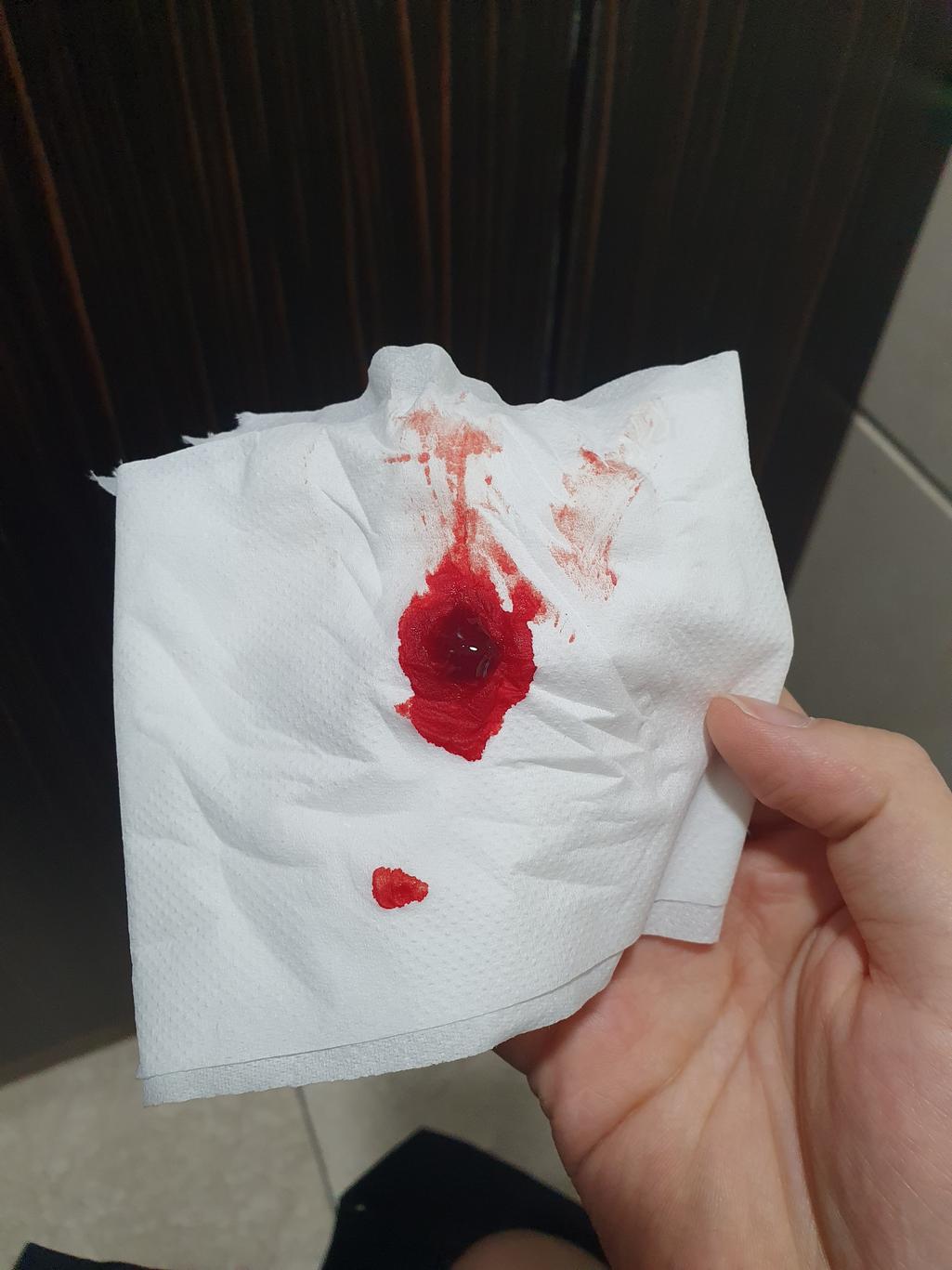 1번 째 사진