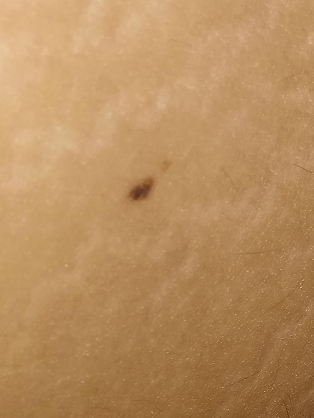 6번 째 사진