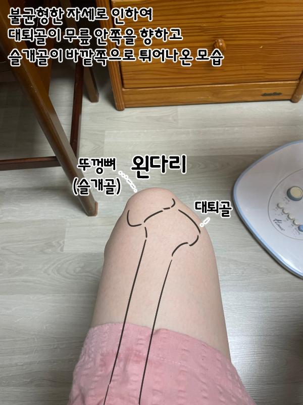 2번 째 사진