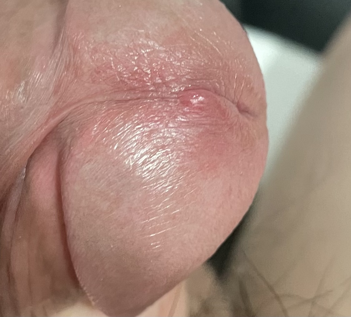 3번 째 사진