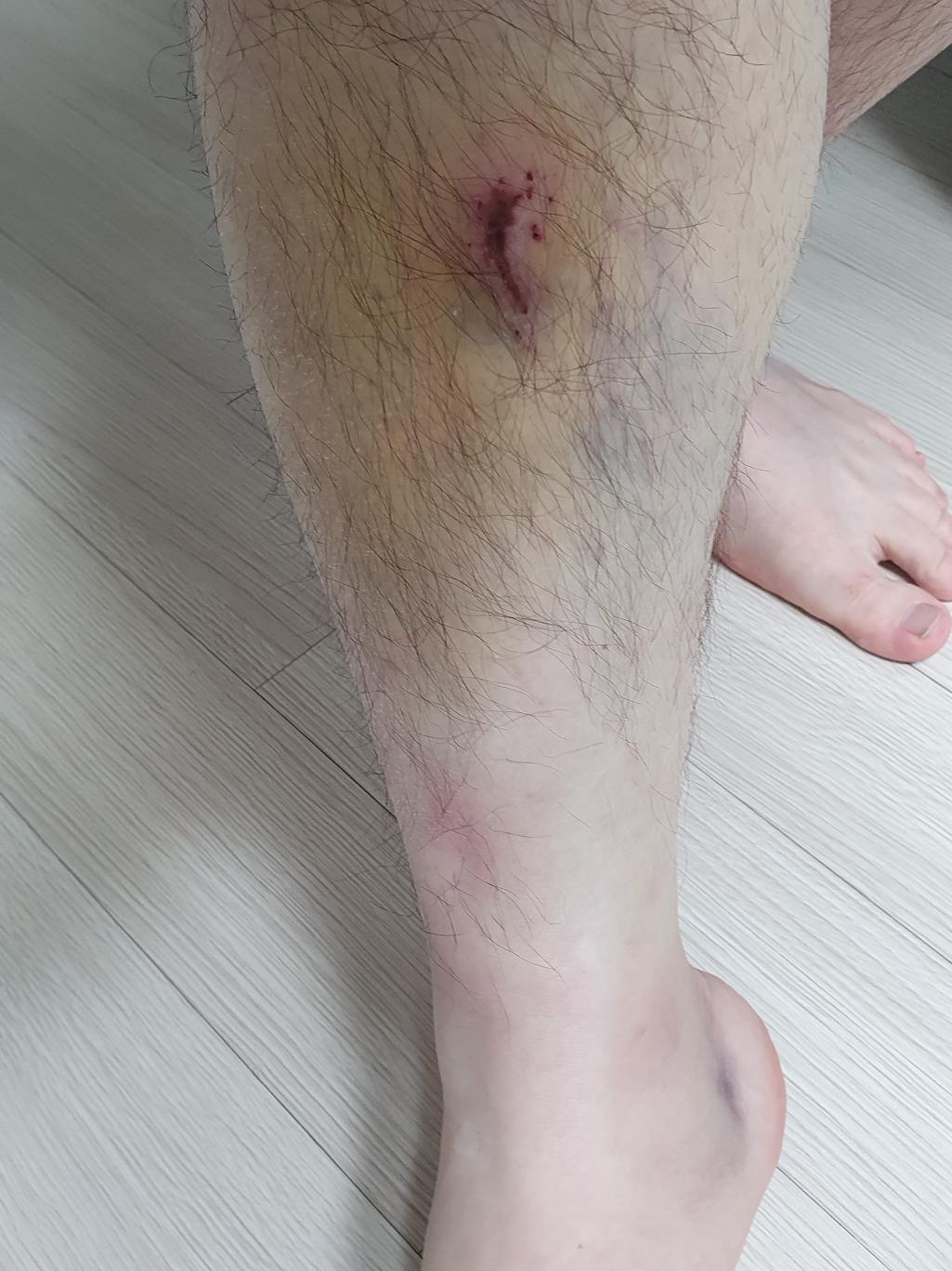 1번 째 사진