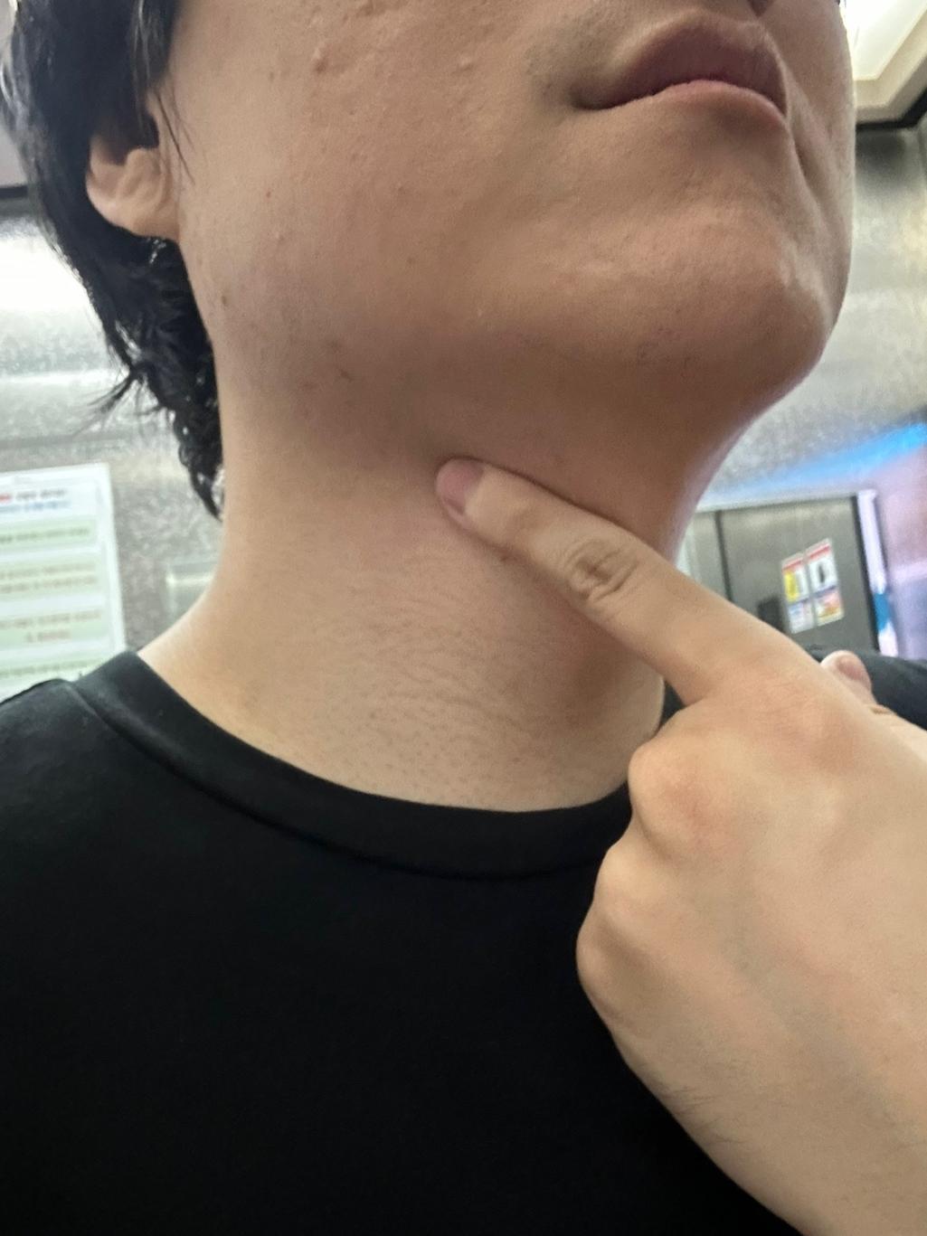 1번 째 사진