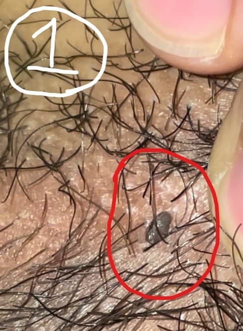 2번 째 사진