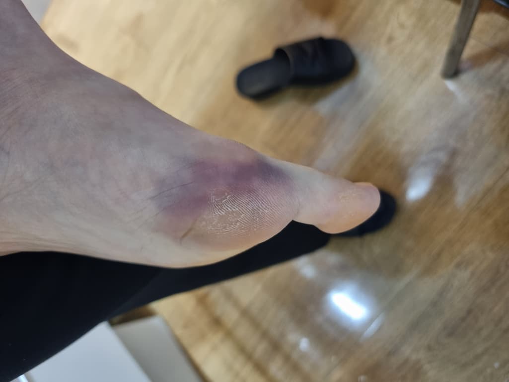 2번 째 사진