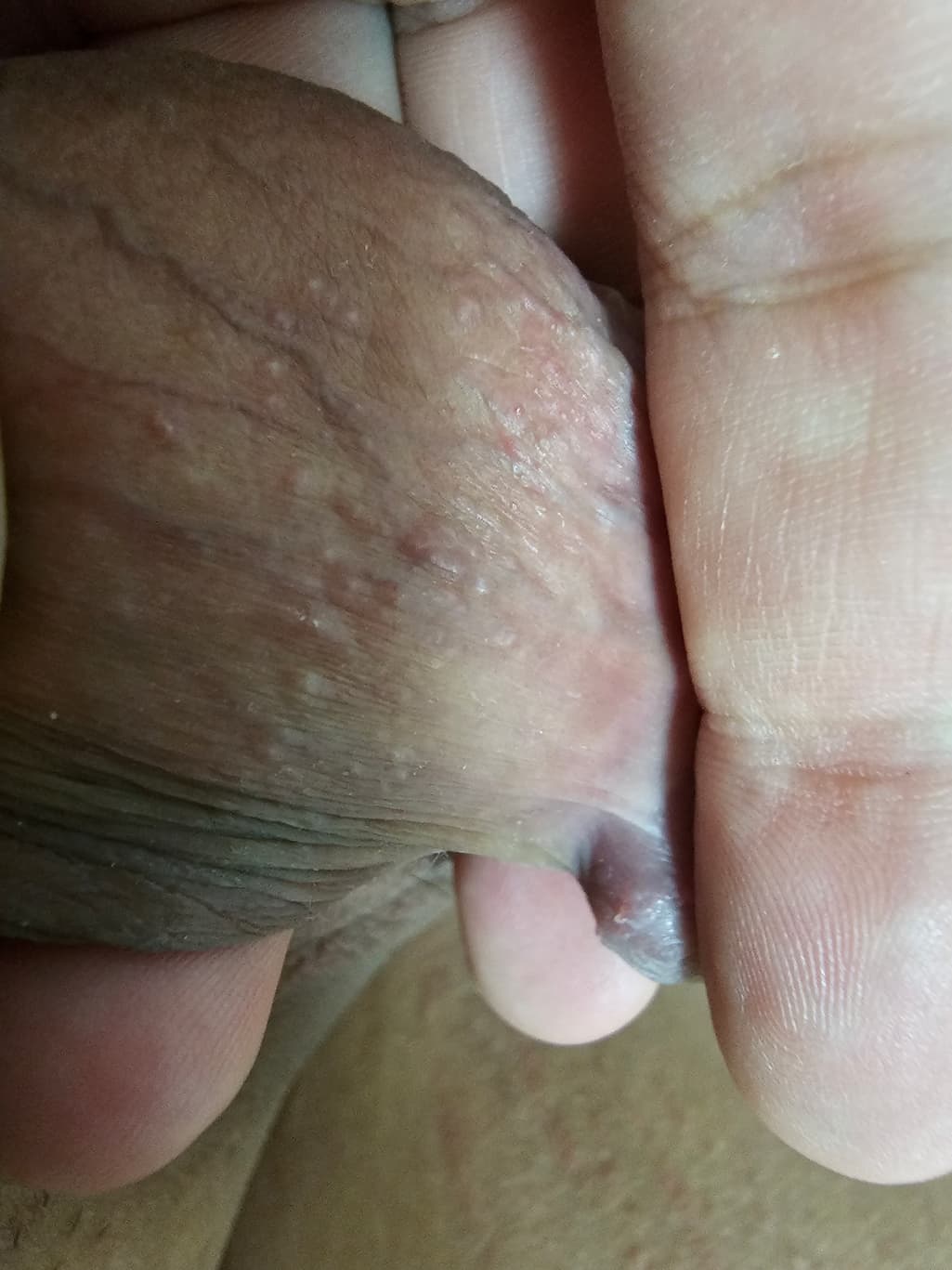2번 째 사진