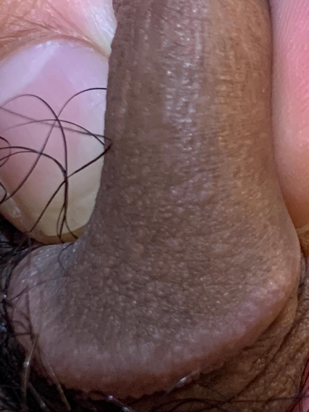 2번 째 사진