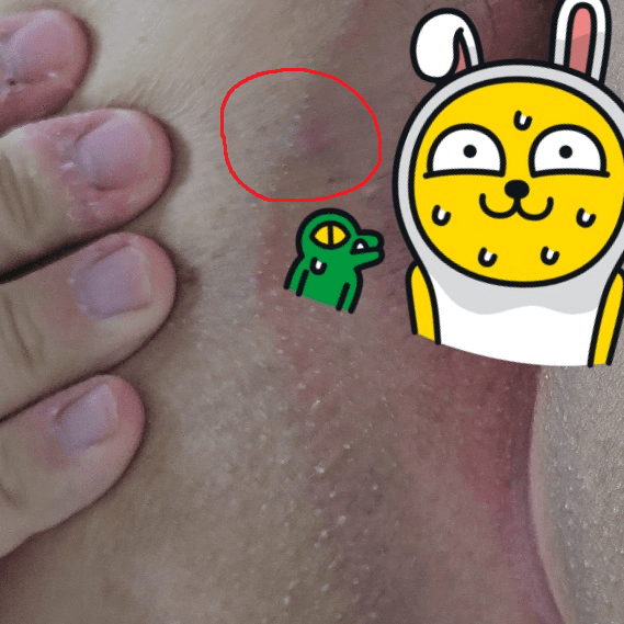 3번 째 사진
