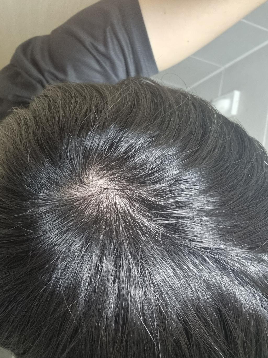 2번 째 사진