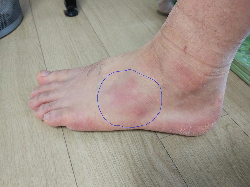 1번 째 사진